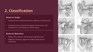 Middle-Ear-Tumours by Allen James David .pptx