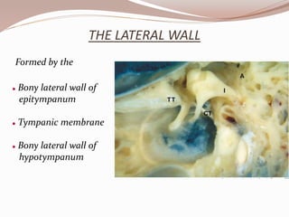 THE LATERAL WALL
Formed by the
 Bony lateral wall of
epitympanum
 Tympanic membrane
 Bony lateral wall of
hypotympanum
 