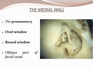 THE MEDIAL WALL
 The promontory
 Oval window
 Round window
 Oblique part of
facial canal
 