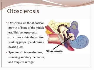 Otosclerosis
 Otosclerosis is the abnormal
growth of bone of the middle
ear. This bone prevents
structures within the ear from
working properly and causes
hearing loss
 Symptoms: Severe tinnitus,
recurring auditory memories,
and frequent vertigo
 