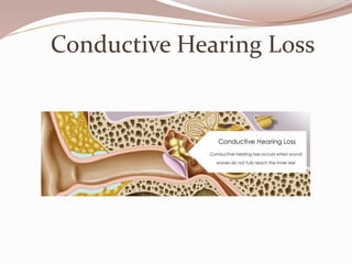 Conductive Hearing Loss
 