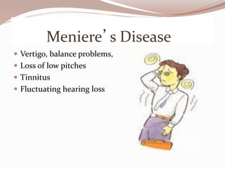 Meniere’s Disease
 Vertigo, balance problems,
 Loss of low pitches
 Tinnitus
 Fluctuating hearing loss
 