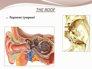 THE ROOF
 Tegment tympani
 