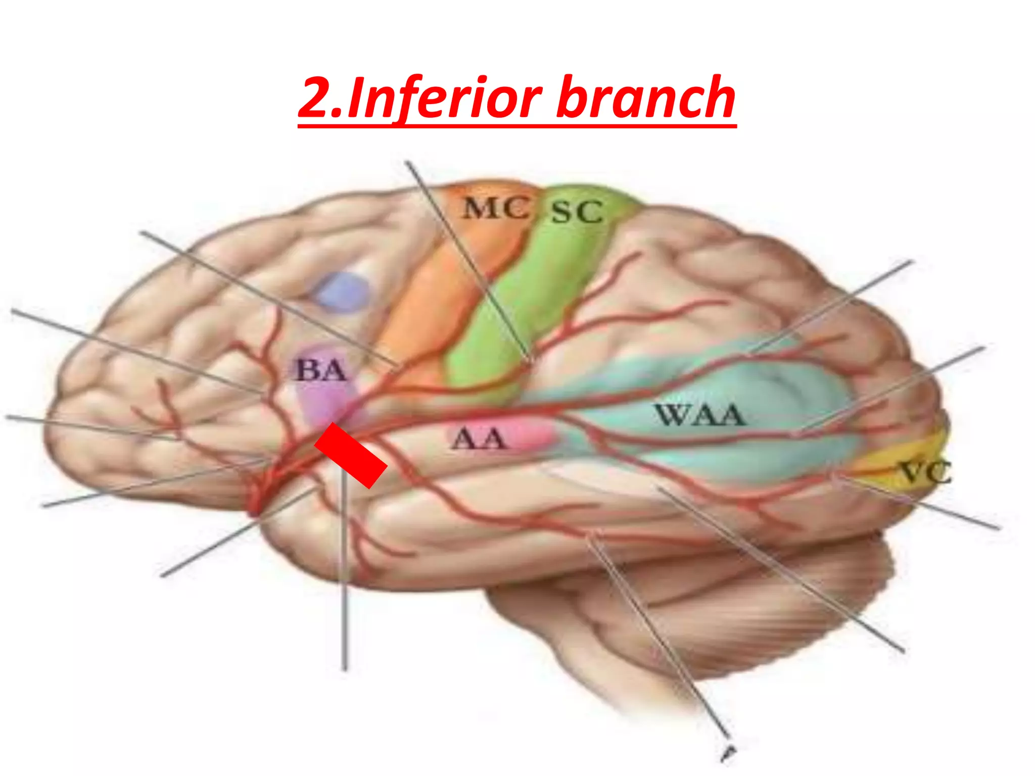 Middle cerebral artery branches | PPTX
