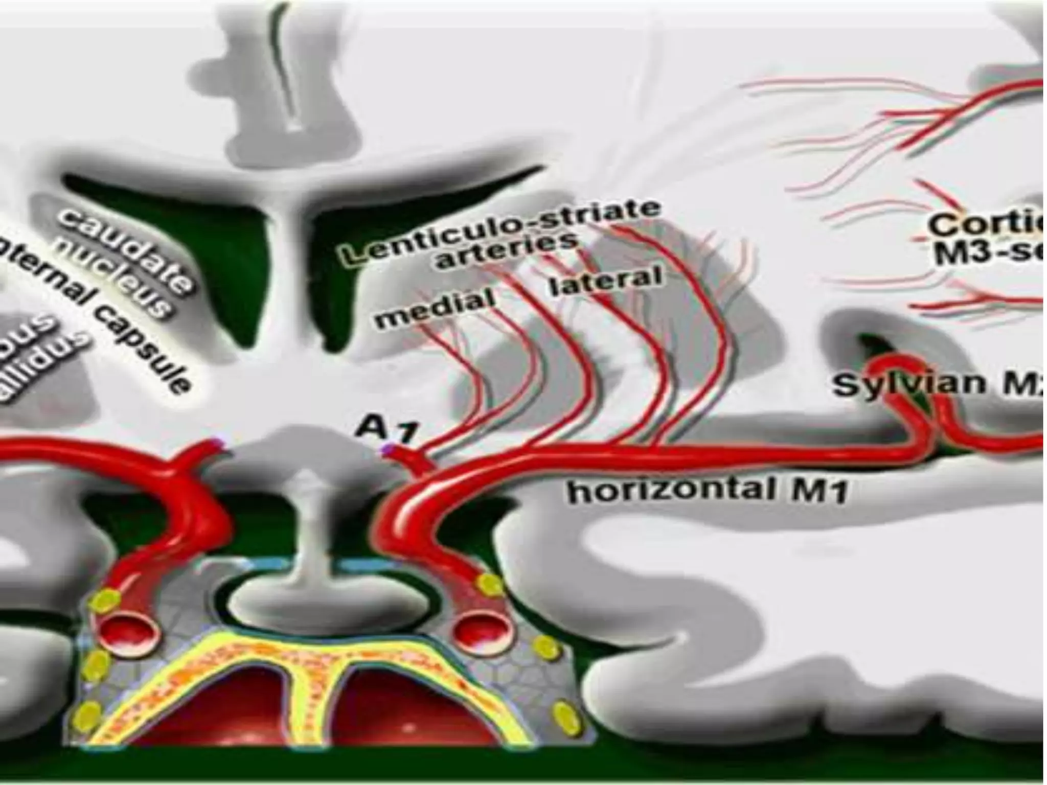 Middle Cerebral Artery Syndromes | PPTX
