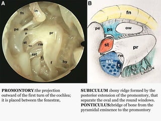 MIDDLE EAR SURGICAL ANATOMY .pptx