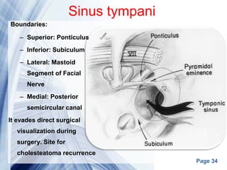 Page 34
Sinus tympani
Boundaries:
– Superior: Ponticulus
– Inferior: Subiculum
– Lateral: Mastoid
Segment of Facial
Nerve
– Medial: Posterior
semicircular canal
It evades direct surgical
visualization during
surgery. Site for
cholesteatoma recurrence
 