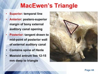 Page 44
MacEwen’s Triangle
• Superior: temporal line
• Anterior: postero-superior
margin of bony external
auditory canal opening
• Posterior: tangent drawn to
mid-point of posterior wall
of external auditory canal
• Contains spine of Henle
• Mastoid antrum lies 12-15
mm deep to triangle
 