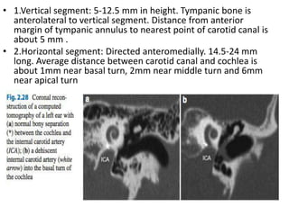 • 1.Vertical segment: 5-12.5 mm in height. Tympanic bone is
anterolateral to vertical segment. Distance from anterior
margin of tympanic annulus to nearest point of carotid canal is
about 5 mm .
• 2.Horizontal segment: Directed anteromedially. 14.5-24 mm
long. Average distance between carotid canal and cochlea is
about 1mm near basal turn, 2mm near middle turn and 6mm
near apical turn
 