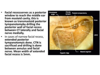 Middle ear__anatom_ytuesday[1] | PPTX
