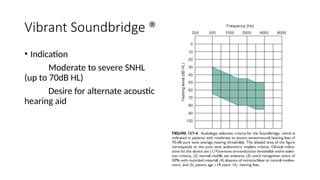 Vibrant Soundbridge ®
• Indication
Moderate to severe SNHL
(up to 70dB HL)
Desire for alternate acoustic
hearing aid
 
