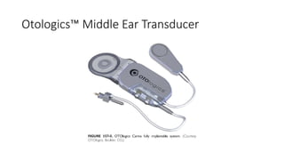 Otologics™ Middle Ear Transducer
 