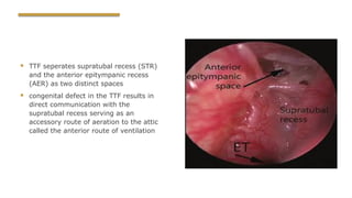 middle ear spaces and mucosal folds Otorhinolaryngology | PPTX