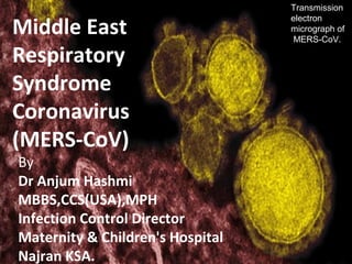 Middle East
Respiratory
Syndrome
Coronavirus
(MERS-CoV)
By
Dr Anjum Hashmi
MBBS,CCS(USA),MPH
Infection Control Director
Maternity & Children's Hospital
Najran KSA.
Transmission
electron
micrograph of
MERS-CoV.
 