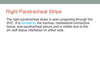 Right Paratracheal Stripe
The right paratracheal stripe is seen projecting through the
SVC. It is formed by the trachea, mediastinal connective
tissue, and paratracheal pleura and is visible due to the
air–soft tissue interfaces on either side.
 