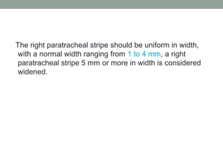 The right paratracheal stripe should be uniform in width,
with a normal width ranging from 1 to 4 mm, a right
paratracheal stripe 5 mm or more in width is considered
widened.
 