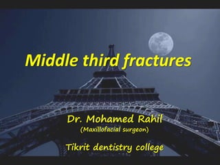 Middle third fractures
Dr. Mohamed Rahil
(Maxillofacial surgeon)
Tikrit dentistry college
 