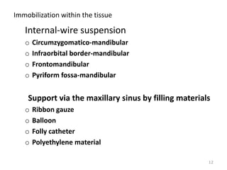 Immobilization within the tissue
Internal-wire suspension
o Circumzygomatico-mandibular
o Infraorbital border-mandibular
o Frontomandibular
o Pyriform fossa-mandibular
Support via the maxillary sinus by filling materials
o Ribbon gauze
o Balloon
o Folly catheter
o Polyethylene material
12
 