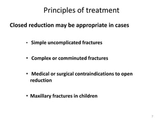 Principles of treatment
Closed reduction may be appropriate in cases
• Simple uncomplicated fractures
• Complex or comminuted fractures
• Medical or surgical contraindications to open
reduction
• Maxillary fractures in children
7
 