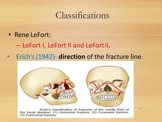 Classifications
13
• Rene LeFort:
– LeFort I, LeFort II and LeFortII.
• Erich’s (1942)- direction of the fracture line.
 