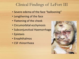 Clinical Findings of LeFort III
27
• Severe edema of the face “ballooning”
• Lengthening of the face
• Flattening of the cheek
• Circumorbital ecchymosis
• Subconjunctival Haemorrhage
• Epistaxis
• Enophthalmos
• CSF rhinorrhoea
 