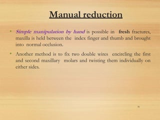 Manual reduction
• Simple manipulation by hand is possible in fresh fractures,
maxilla is held between the index finger and thumb and brought
into normal occlusion.
• Another method is to fix two double wires encircling the first
and second maxillary molars and twisting them individually on
either sides.
35
 