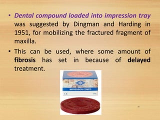 • Dental compound loaded into impression tray
was suggested by Dingman and Harding in
1951, for mobilizing the fractured fragment of
maxilla.
• This can be used, where some amount of
fibrosis has set in because of delayed
treatment.
37
 