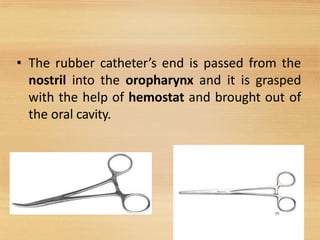 • The rubber catheter’s end is passed from the
nostril into the oropharynx and it is grasped
with the help of hemostat and brought out of
the oral cavity.
39
 