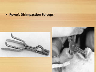 • Rowe’s Disimpaction Forceps
43
 