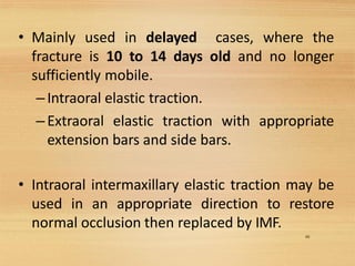 48
• Mainly used in delayed cases, where the
fracture is 10 to 14 days old and no longer
sufficiently mobile.
–Intraoral elastic traction.
–Extraoral elastic traction with appropriate
extension bars and side bars.
• Intraoral intermaxillary elastic traction may be
used in an appropriate direction to restore
normal occlusion then replaced by IMF.
 