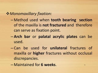 51
❖Monomaxillary fixation:
–Method used when tooth bearing section
of the maxilla is not fractured and therefore
can serve as fixation point.
–Arch bar or palatal acrylic plates can be
used.
–Can be used for unilateral fractures of
maxilla or higher fractures without occlusal
discrepancies.
–Maintained for 6 weeks.
 
