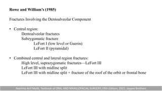 Rowe and William’s (1985)
Fractures Involving the Dentoalveolar Component
• Central region:
Dentoalveolar fractures
Subzygomatic fracture
LeFort I (low level or Guerin)
LeFort II (pyramidal)
• Combined central and lateral region fractures:
High level, suprazygomatic fractures—LeFort III
LeFort III with midline split
LeFort III with midline split + fracture of the roof of the orbit or frontal bone
Neelima Anil Malik; Textbook of ORAL AND MAXILLOFACIAL SURGERY; Fifth Edition; 2021; Jaypee Brothers
 