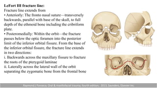 LeFort III fracture line:
Fracture line extends from
• Anteriorly: The fronto nasal suture—transversely
backwards, parallel with base of the skull, to full
depth of the ethmoid bone including the cribriform
plate.
• Posteromedially: Within the orbit—the fracture
passes below the optic foramen into the posterior
limit of the inferior orbital fissure. From the base of
the inferior orbital fissure, the fracture line extends
in two directions:
i. Backwards across the maxillary fissure to fracture
the roots of the pterygoid laminae
ii. Laterally across the lateral wall of the orbit
separating the zygomatic bone from the frontal bone
Raymond.J Fonseca; Oral & maxillofacial trauma; fourth edition; 2013, Saunders, Elsevier Inc
 