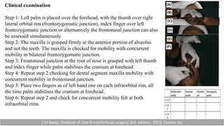 Clinical examination
Step 1: Left palm is placed over the forehead, with the thumb over right
lateral orbital rim (frontozygomatic junction), index finger over left
frontozygomatic junction or alternatively the frontonasal junction can also
be assessed simultaneously.
Step 2: The maxilla is grasped firmly at the anterior portion of alveolus
and not the teeth. The maxilla is checked for mobility with concurrent
mobility in bilateral frontozygomatic junction.
Step 3: Frontonasal junction at the root of nose is grasped with left thumb
and index finger while palm stabilises the cranium at forehead.
Step 4: Repeat step 2 checking for dental segment maxilla mobility with
concurrent mobility in frontonasal junction.
Step 5: Place two fingers as of left hand one on each infraorbital rim, all
the time palm stabilises the cranium at forehead.
Step 6: Repeat step 2 and check for concurrent mobility felt at both
infraorbital rims.
S M Balaji; Textbook of Oral & maxillofacial surgery; 3rd edition; 2019, Elsevier Inc
 