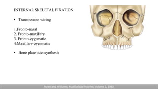INTERNAL SKELETAL FIXATION
• Transosseous wiring
1.Fronto-nasal
2. Fronto-maxillary
3. Fronto-zygomatic
4.Maxillary-zygomatic
• Bone plate osteosynthesis
Rowe and Williams; Maxillofacial Injuries; Volume 2; 1985
 