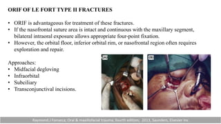 ORIF OF LE FORT TYPE II FRACTURES
• ORIF is advantageous for treatment of these fractures.
• If the nasofrontal suture area is intact and continuous with the maxillary segment,
bilateral intraoral exposure allows appropriate four-point fixation.
• However, the orbital floor, inferior orbital rim, or nasofrontal region often requires
exploration and repair.
Approaches:
• Midfacial degloving
• Infraorbital
• Subciliary
• Transconjunctival incisions.
Raymond.J Fonseca; Oral & maxillofacial trauma; fourth edition; 2013, Saunders, Elsevier Inc
 