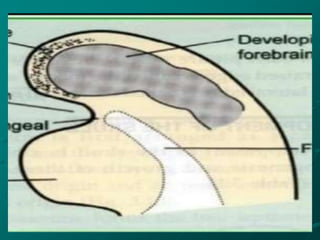 Midface Fracture Part-1.ppt