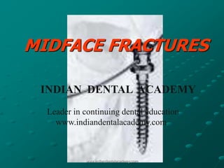 MIDFACE FRACTURES
INDIAN DENTAL ACADEMY
Leader in continuing dental education
www.indiandentalacademy.com

www.indiandentalacademy.com

 