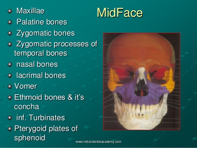 Mid face fractures /certified fixed orthodontic courses by Indian den…