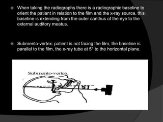 

When taking the radiographs there is a radiographic baseline to
orient the patient in relation to the film and the x-ray source, this
baseline is extending from the outer canthus of the eye to the
external auditory meatus.



Submento-vertex: patient is not facing the film, the baseline is
parallel to the film, the x-ray tube at 5° to the horizontal plane.

 