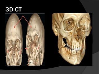 3D CT

 