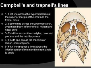Campbell's and trapnell's lines









1- First line across the zygomaticofrontal,
the superior margin of the orbit and the
frontal sinus
2- Second line across the zygomatic arch,
zygomatic body, inferior orbital margin and
nasal bone
3- Third line across the condyles, coronoid
process and the maxillary sinus
4- Fourth line across the mandibular
ramus, occlusal plane
5- Fifth line (trapnell's line) across the
inferior border of the mandible from angle
to angle

 