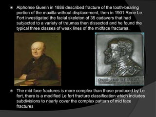 

Alphonse Guerin in 1886 described fracture of the tooth-bearing
portion of the maxilla without displacement, then in 1901 Rene Le
Fort investigated the facial skeleton of 35 cadavers that had
subjected to a variety of traumas then dissected and he found the
typical three classes of weak lines of the midface fractures.



The mid face fractures is more complex than those produced by Le
fort, there is a modified Le fort fracture classification which includes
subdivisions to nearly cover the complex pattern of mid face
fractures

 