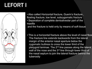 LEFORT I
• Also called Horizontal fracture, Guerin‟s fracture ,
floating fracture, low level, subzygomatic fracture
• Separation of complete dentoalveolar part of the
maxilla
and the fracture is held only by means of soft tissue

• This is a horizontal fracture above the level of nasal floor
The fracture line extends backwards from the lateral
margin of the anterior nasal aperture below the
zygomatic buttress to cross the lower third of the
ptetygoid laminae. The 2nd line passes along the lateral
wall of the nose and the 3rd line through lower third of
the nasal septum to join the lateral fracture behind the
tuberosity

 