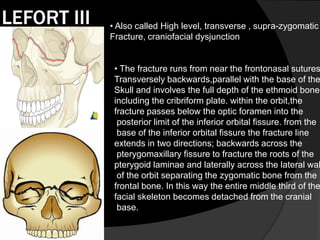 LEFORT III

• Also called High level, transverse , supra-zygomatic
Fracture, craniofacial dysjunction

• The fracture runs from near the frontonasal sutures
Transversely backwards,parallel with the base of the
Skull and involves the full depth of the ethmoid bone,
including the cribriform plate. within the orbit,the
fracture passes below the optic foramen into the
posterior limit of the inferior orbital fissure. from the
base of the inferior orbital fissure the fracture line
extends in two directions; backwards across the
pterygomaxillary fissure to fracture the roots of the
pterygoid laminae and laterally across the lateral wal
of the orbit separating the zygomatic bone from the
frontal bone. In this way the entire middle third of the
facial skeleton becomes detached from the cranial
base.

 