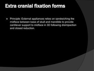 Extra cranial fixation forms


Principle: External appliances relies on sandwiching the
midface between base of skull and mandible to provide
cantilever support to midface in 3D following disimpaction
and closed reduction.

 