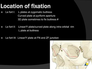 Location of fixation


Le fort I:

L plates at zygomatic buttress
Curved plate at pyriform aperture
3D plate sometimes to fix buttress #



Le fort II:

Linear/Y plate/curved plate along intra orbital rim
L plate at buttress



Le fort III: Linear/Y plate at FN and ZF junction

 