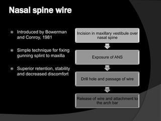 Nasal spine wire


Introduced by Bowerman
and Conroy, 1981



Simple technique for fixing
gunning splint to maxilla



Incision in maxillary vestibule over
nasal spine

Exposure of ANS

Superior retention, stability
and decreased discomfort
Drill hole and passage of wire

Release of wire and attachment to
the arch bar

 