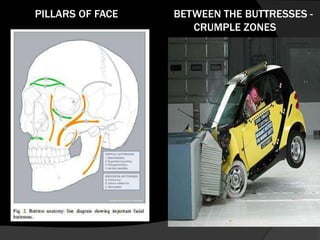 PILLARS OF FACE

BETWEEN THE BUTTRESSES CRUMPLE ZONES

 