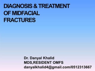 DIAGNOSIS&TREATMENT
OFMIDFACIAL
FRACTURES
Dr. Danyal Khalid
MDS,RESIDENT OMFS
danyalkhalid4@gmail.com/0512313667
 
